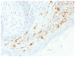 CD1a Rabbit anti-Human, Clone-C1A/1506R, Novus Biologicals:Antibodies:Primary