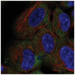 CD1d Antibody, Novus Biologicals 25 &mu;L, Unlabeled:Antibodies, Polyclonal