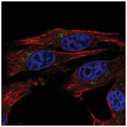 CD39L2/ENTPD6 Antibody, Novus Biologicals:Antibodies:Primary Antibodies