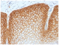 CD44, variant 4 Rabbit anti-Human, Clone-CD44v4/1700R, Novus Biologicals