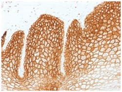 CD44, variant 6 Mouse anti-Human, Clone-CD44v6/1246, Novus Biologicals