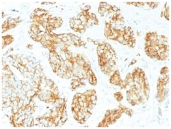 CD44, variant 9 Mouse anti-Human, Clone-CD44v9/1459, Novus Biologicals:Antikörper:Primärantikörper