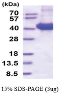 Novus Biologicals&trade;&nbsp;Recombinant Human CD46 Protein