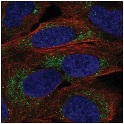 CD77 Synthase Antibody, Novus Biologicals:Antibodies:Primary Antibodies