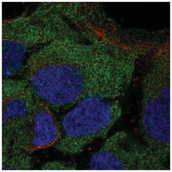CD8 beta Antibody, Novus Biologicals 100&mu;L; Unlabeled:Antibodies, Polyclonal