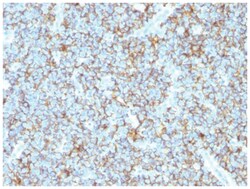 CD99 Rabbit anti-Human, Clone-MIC2/1495R, Novus Biologicals 200&mu;g; Unlabeled:Antibodies,