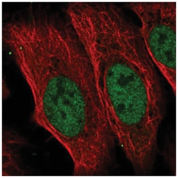 CDADC1 Antibody, Novus Biologicals:Antibodies:Primary Antibodies