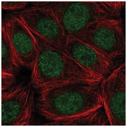 CDC73/HRPT2 Antibody, Novus Biologicals 100&mu;L; Unlabeled:Antibodies,
