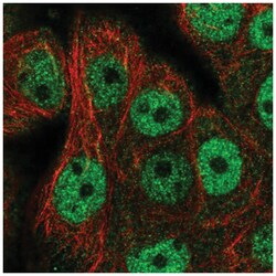 CDCA4 Antibody, Novus Biologicals:Antibodies:Primary Antibodies