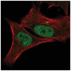 CDK2 Antibody, Novus Biologicals 100&mu;L; Unlabeled:Antibodies, Polyclonal