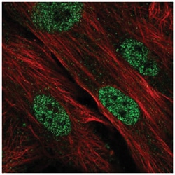 CDK2AP1 Antibody, Novus Biologicals 25 &mu;L, Unlabeled:Antibodies, Polyclonal