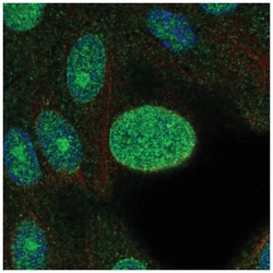 CDK4 Antibody, Novus Biologicals 25 &mu;L; Unlabeled:Antibodies, Polyclonal