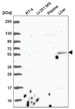 CDK5RAP1 Antibody, Novus Biologicals 25 &mu;L:Antibodies, Polyclonal
