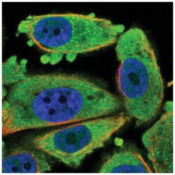 CDKN3 Antibody, Novus Biologicals 25 &mu;L, Unlabeled:Antibodies, Polyclonal