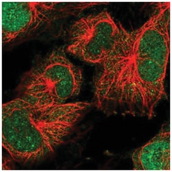 CDT2 Antibody, Novus Biologicals:Antibodies:Primary Antibodies