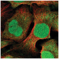 CDT2 Antibody, Novus Biologicals:Antibodies:Primary Antibodies