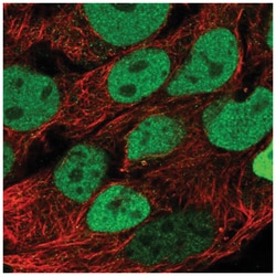 CDX2 Antibody, Novus Biologicals 100&mu;L; Unlabeled:Antibodies, Polyclonal