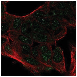 CEBP alpha Antibody, Novus Biologicals 25 &mu;L, Unlabeled:Antibodies,