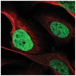 CEBP Beta Antibody, Novus Biologicals 100&mu;L; Unlabeled:Antibodies, Polyclonal