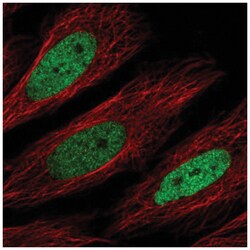 CEBP Delta Antibody, Novus Biologicals:Antibodies:Primary Antibodies