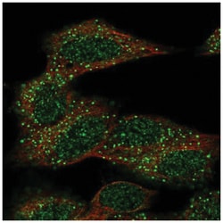 CECR6 Antibody, Novus Biologicals 25 &mu;L:Antibodies, Polyclonal