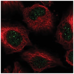 CENPB Antibody, Novus Biologicals 25 &mu;L:Antibodies, Polyclonal