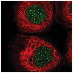 CENPB Antibody, Novus Biologicals:Antibodies:Primary Antibodies