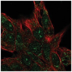 CENPBD1 Antibody, Novus Biologicals:Antibodies:Primary Antibodies