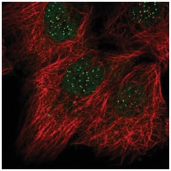 CENPC Antibody, Novus Biologicals 25 &mu;L:Antibodies, Polyclonal