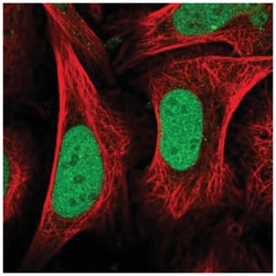 CENPQ Antibody, Novus Biologicals 100&mu;L; Unlabeled:Antibodies, Polyclonal