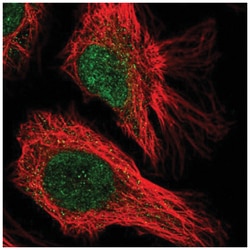 CENPQ Antibody, Novus Biologicals 25 &mu;L, Unlabeled:Antibodies, Polyclonal