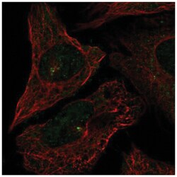 CEP72 Antibody, Novus Biologicals 100 &mu;L | Buy Online | Novus Biologicals | Fisher Scientific