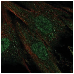 Ceramide Kinase Like Antibody, Novus Biologicals 100&mu;L; Unlabeled:Antibodies,