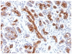 CFTR Mouse anti-Human, Clone-CFTR/1341, Novus Biologicals:Antibodies:Primary