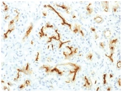 CFTR Rabbit anti-Human, Clone-CFTR/1775R, Novus Biologicals 100&mu;g; Unlabeled:Antibodies,