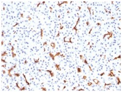CFTR Mouse anti-Human, Clone-CFTR/1785, Novus Biologicals:Antibodies:Primary