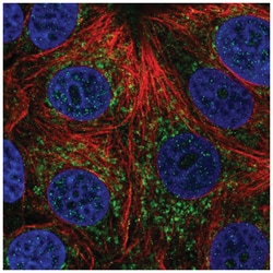 CHCHD4 Antibody, Novus Biologicals 100&mu;L; Unlabeled:Antibodies, Polyclonal