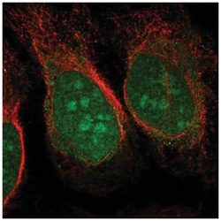 CHD3 Antibody, Novus Biologicals:Antibodies:Primary Antibodies