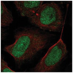 CHD7 Antibody, Novus Biologicals 100&mu;L; Unlabeled:Antibodies, Polyclonal