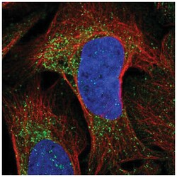 Chemokine-like factor Antibody, Novus Biologicals 100&mu;L; Unlabeled:Antibodies,