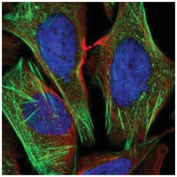 ChGn Antibody, Novus Biologicals 100&mu;L; Unlabeled:Antibodies, Polyclonal
