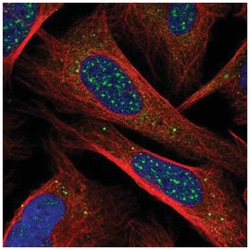 CHIC1 Antibody, Novus Biologicals:Antibodies:Primary Antibodies