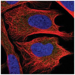 CHMP2B Antibody, Novus Biologicals:Antibodies:Primary Antibodies