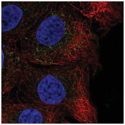 CHST14 Antibody, Novus Biologicals 100&mu;L; Unlabeled:Antibodies, Polyclonal