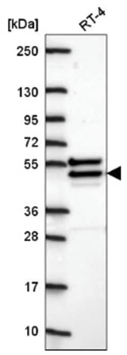 CHST14 Antibody, Novus Biologicals 25 &mu;L, Unlabeled:Antibodies, Polyclonal