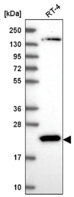 CIB1 Antibody, Novus Biologicals 100&mu;L; Unlabeled:Antibodies, Polyclonal