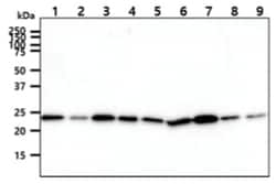 CINP Mouse anti-Human, Clone: 1G10, Novus Biologicals 100&mu;L; Unlabeled:Antibodies,