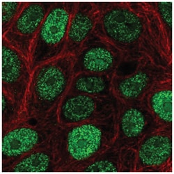 CIRBP Antibody, Novus Biologicals 100&mu;L; Unlabeled:Antibodies, Polyclonal