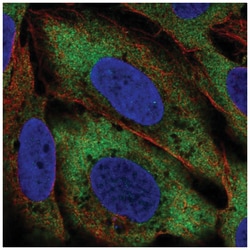 Citron Kinase Antibody, Novus Biologicals 100&mu;L; Unlabeled:Antibodies,