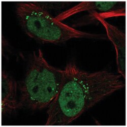 Claspin Antibody, Novus Biologicals:Antibodies:Primary Antibodies